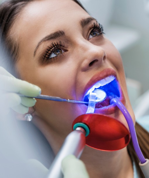 Dental Laser, Surrey Dentist