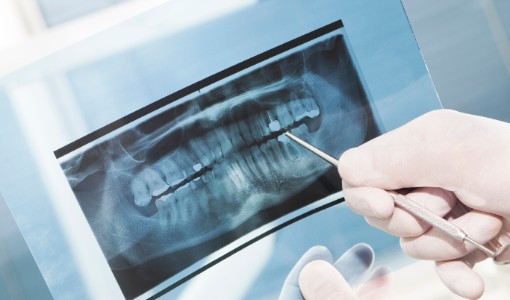 Dental Technology, Surrey Dentist