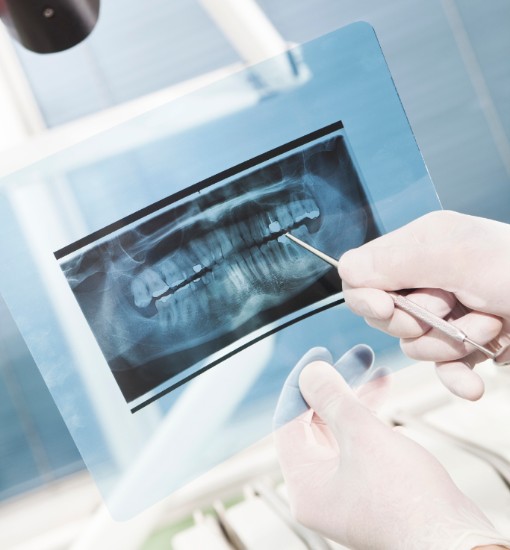 Dental X-Rays, Surrey Dentist